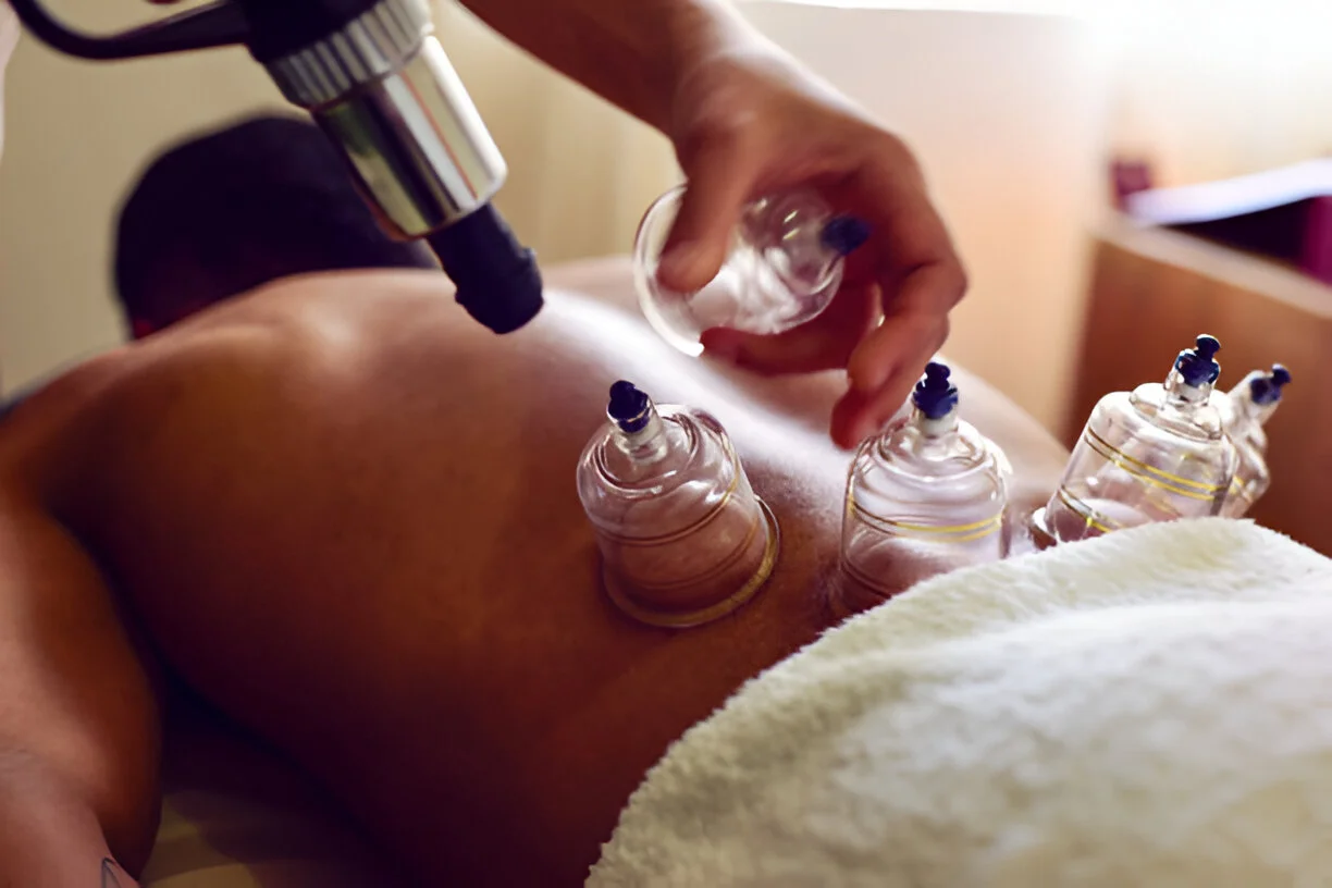 Professional hijama cupping therapy treatment session